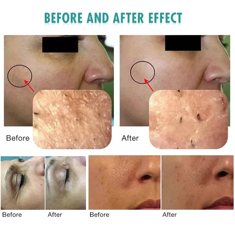 3 In 1 Ultrasound Oxygen Bubble Facial Lifting Skin Care Whitening CO2 Oxygention Therapy Skin Rejuvenation Moisturizing Machine - PYJ IT Solutions Online Shop