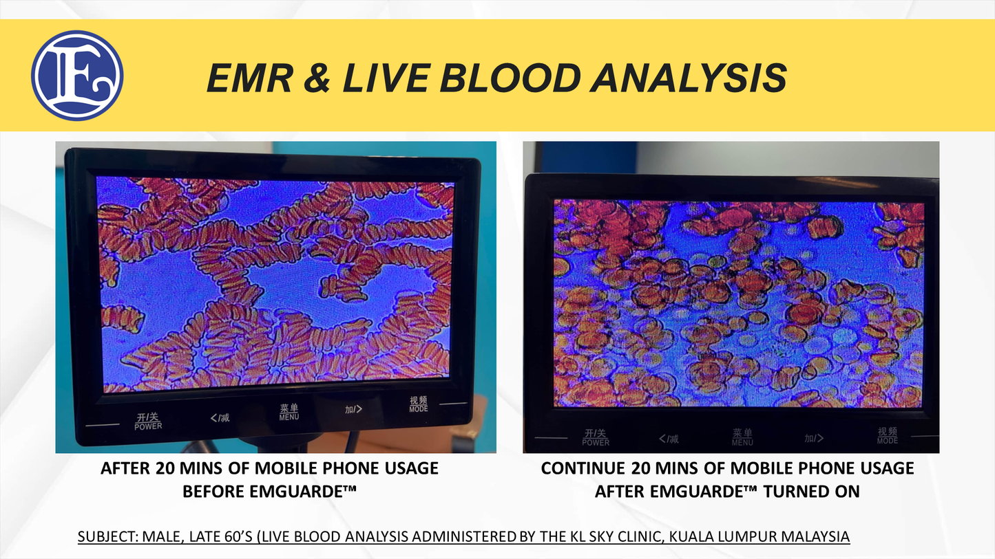 emGuarde - Patented ElectroMagnetic Field (EMF) Harmonizer to Protect Your Health